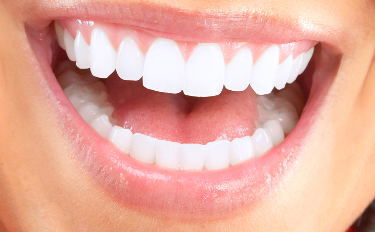Cosmetic dentistry and smile makeover