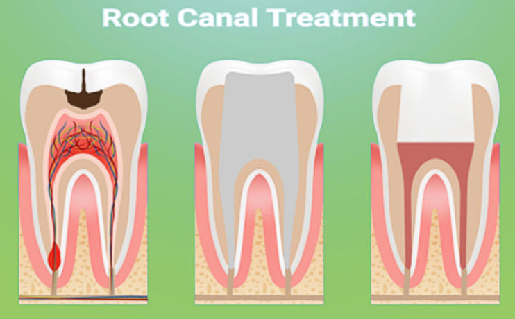 Preventive Dentistry