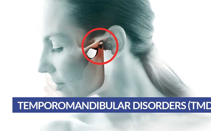 wisdom-tooth-removal