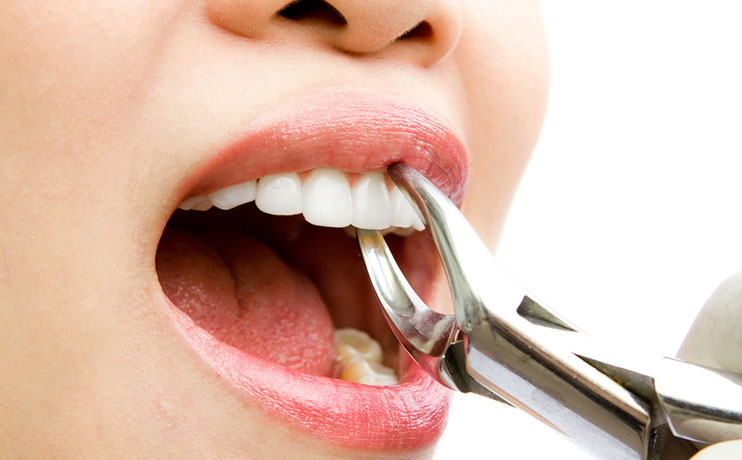 advanced-gum-treatment